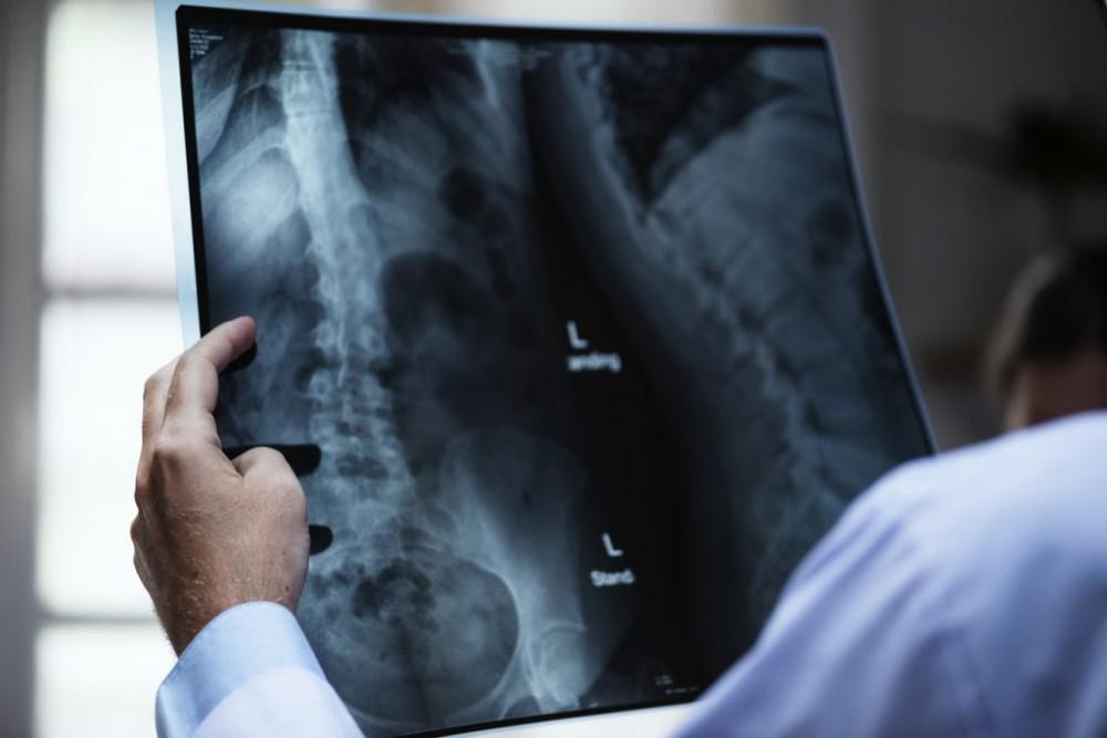 Chiropractor Examining an X-ray